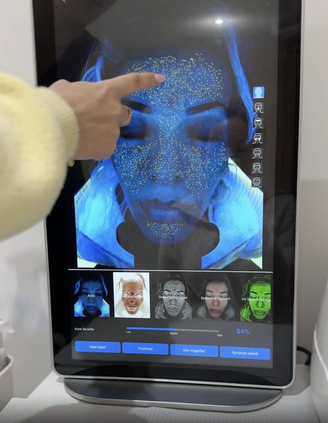 In-clinic skin analysis โ mapping pigmentation, texture and sun damage before CO2 treatment
